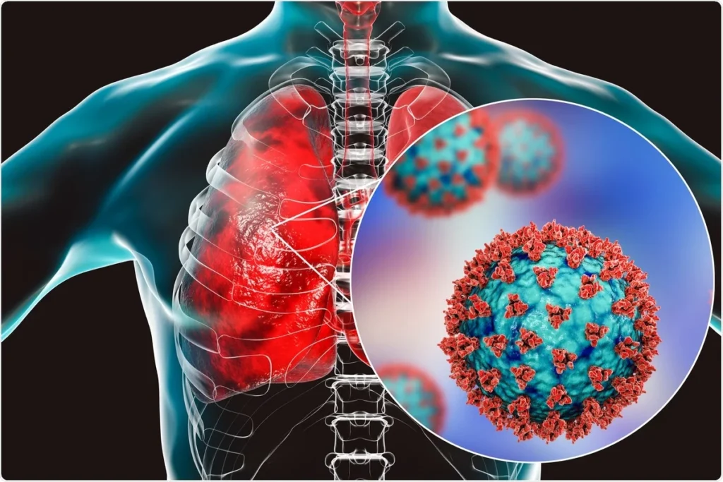 Respiratory System Under Attack